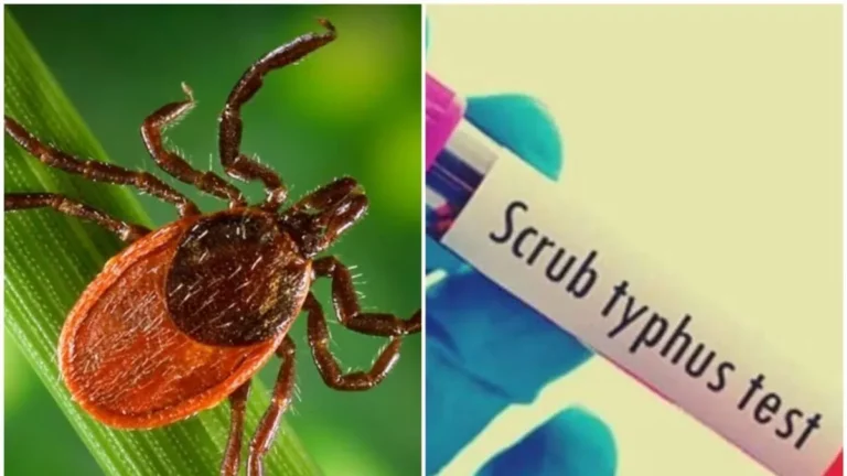 ବରଗଡ଼ରେ ସ୍କ୍ରବ ଟାଇଫସ୍‌ ଆକ୍ରାନ୍ତ ଚିହ୍ନଟ