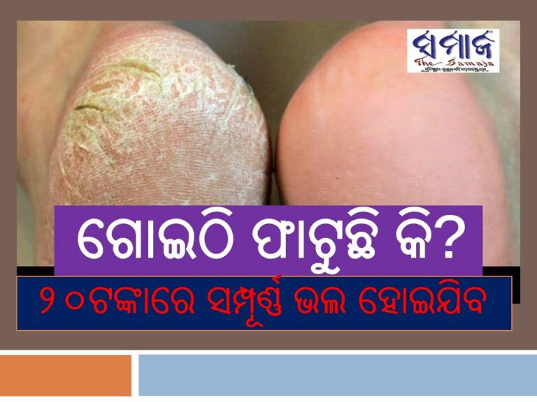 ଶୀତରେ ଗୋଇଠି ଫାଟୁଛି କି? ୨୦ଟଙ୍କାର ଜିନିଷରେ ସମ୍ପୂର୍ଣ୍ଣ ଭଲ ହୋଇଯିବ